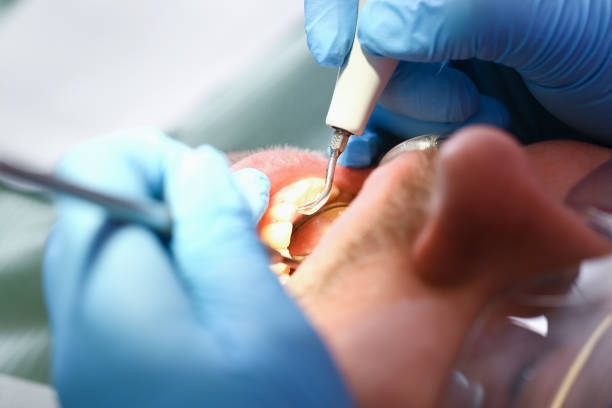 Best Emergency TMJ Treatment in Redland, TX