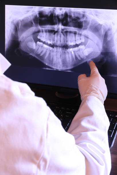 Best Emergency Tooth Extraction in Redland, TX