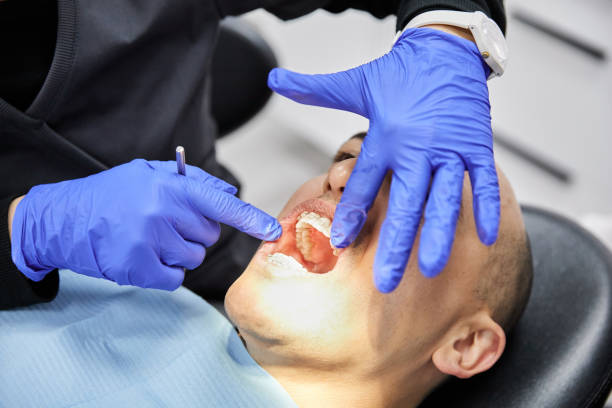 Best Emergency Gum Treatment in Redland, TX